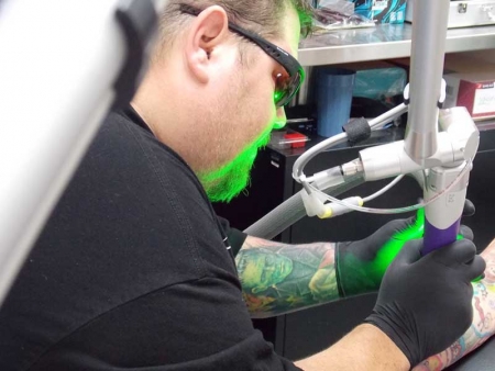 Xtreme Ink helps Kentuckiana erase mistakes with new laser for tattoo removal 